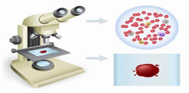 Bloeddruppel onder microscoop