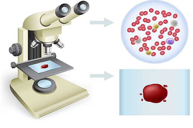 Bloeddruppel onder de microscoop